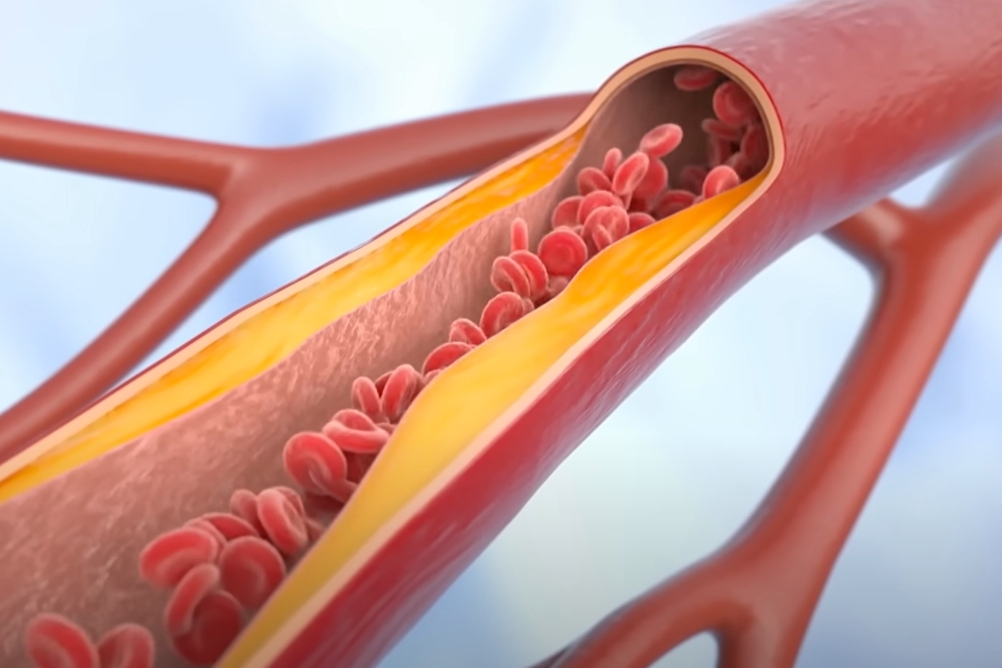 10 Foods That Naturally Boost Blood Flow